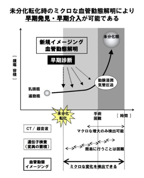 甲状腺